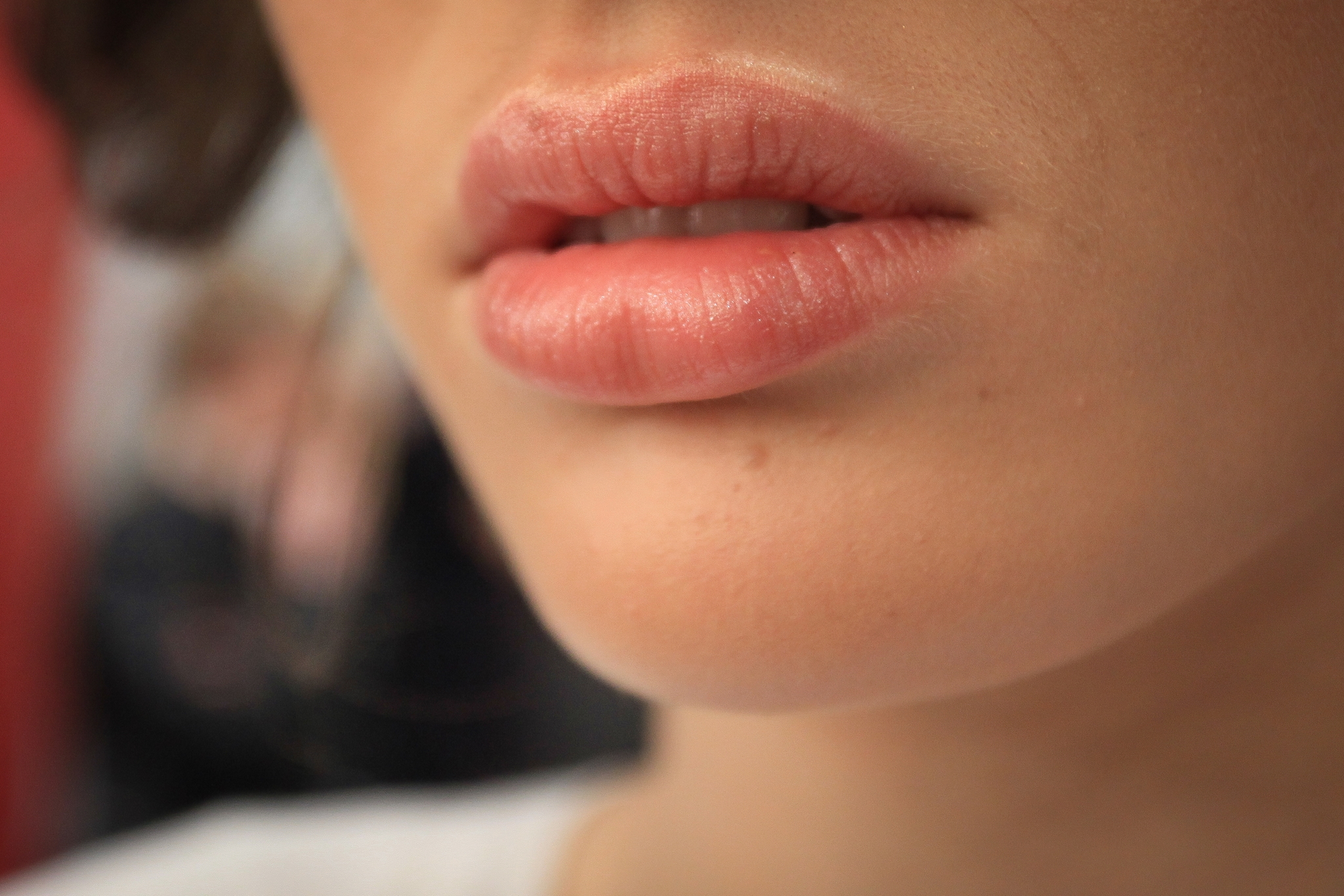 Τι είναι το Lip Flip και τι το κάνει διαφορετικό από το filler χειλιών;